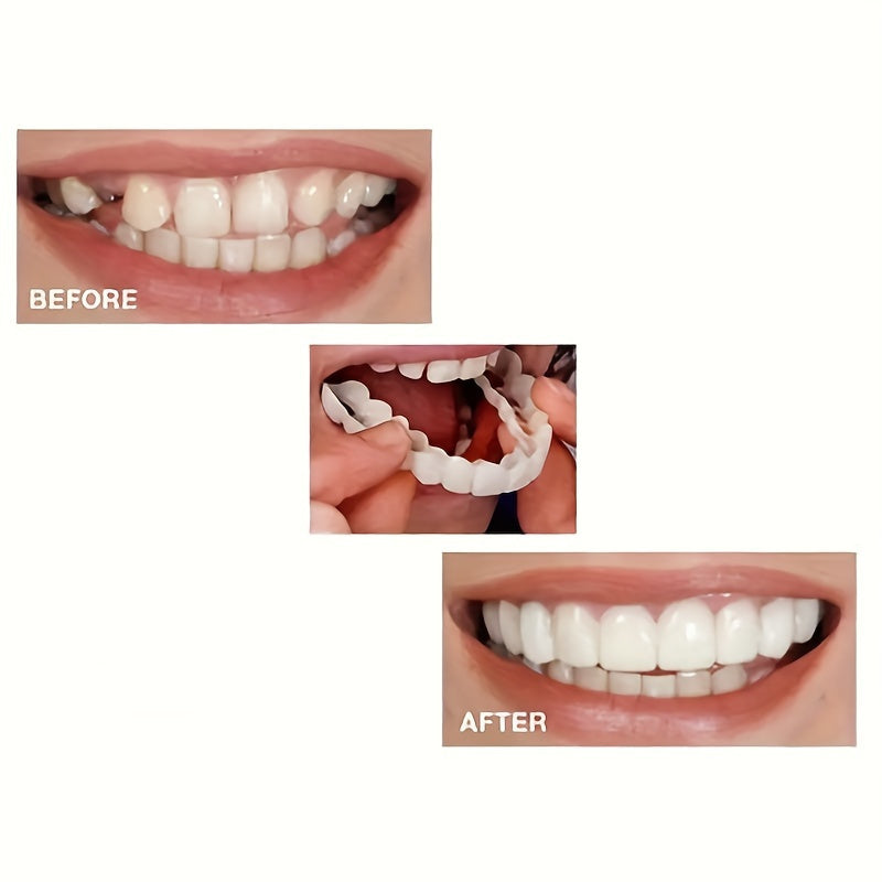 Durable Dental Veneer Kit