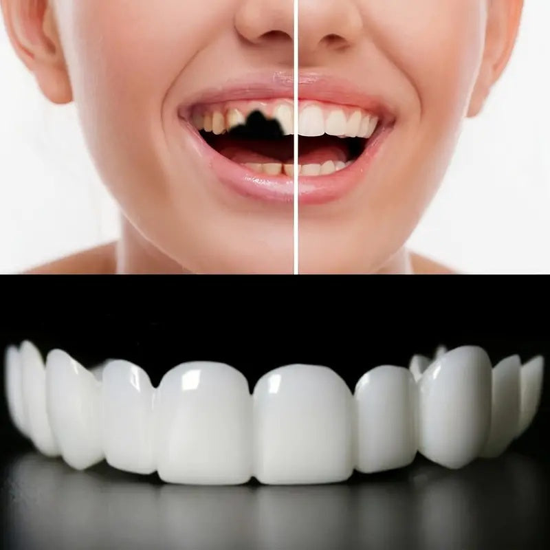 Durable Dental Veneer Kit