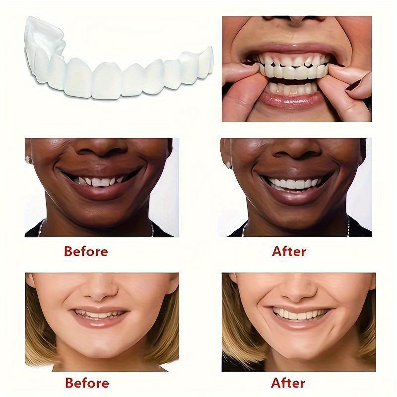 Durable Dental Veneer Kit