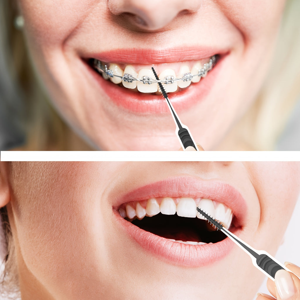 Orthodontic Detail Cleaning Brushes